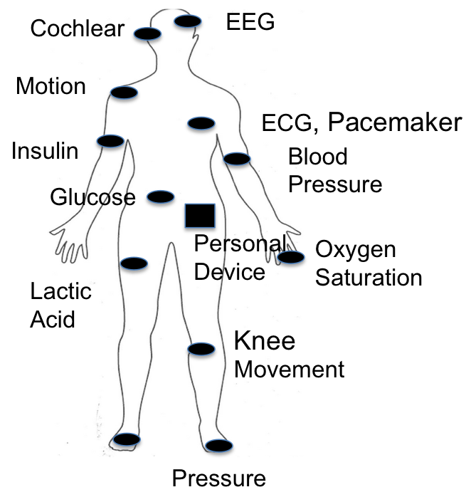 Patient Monitoring