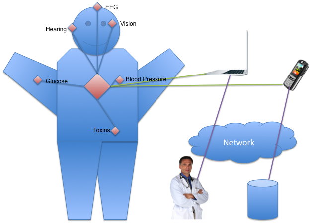 Example ABSN Diagram